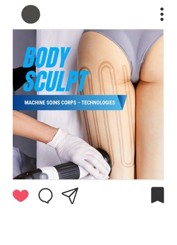 Community Management - Media Fast